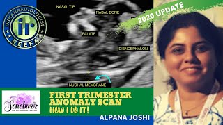 FIRST TRIMESTER ANOMALY SCAN  How I do it by Alpana Joshi  FETAL IMAGING  NASAL BONE amp NT [upl. by Rekyr]