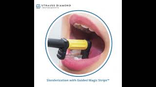 IPR Slenderization with Guided Magic Strips  Strauss Diamond [upl. by Gnouv]