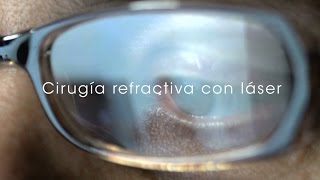 Cirugía refractiva con láser  Lasik [upl. by Einnhoj]