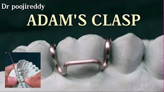 Adams clasp Adams clasp fabrication Dr poojireddy [upl. by Reyotal262]