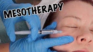 Mesotherapy Facial  Anti Aging Treatment [upl. by Pember643]