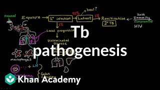 TB pathogenesis  Infectious diseases  NCLEXRN  Khan Academy [upl. by Leahcym]