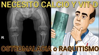 Necesito Calcio y VITAMINA D🙄 o pudiera tener OSTEOMALACIA o RAQUITISMO [upl. by Lark]