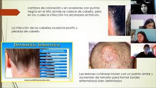 Micosis cutaneas y dermatofitas [upl. by Kendell796]