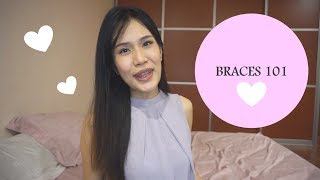 Braces 101 My Braces Journey So Far  Extractions Cost Pain Types of Braces etc [upl. by Naga258]