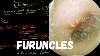 FURUNCLE  Localized Acute Otitis Externa [upl. by Monetta]