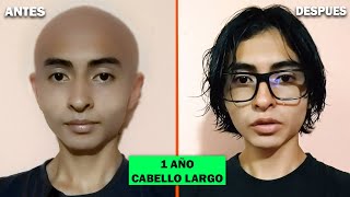 Proceso de crecimiento del cabello por 1 año  Hombres [upl. by Enihsnus]