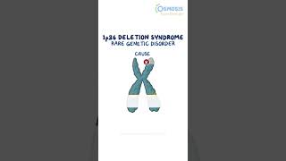 1p36 Deletion Syndrome [upl. by Nomolas]