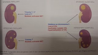 Renal Cell Carcinoma  SPECIAL PATHOLOGY [upl. by Nevuer920]