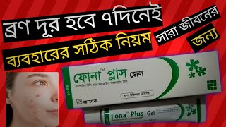 How To Use Fona plus gel Gel On Face  ব্রণ দূর হবে ৭দিনেই Fona plus gel ব্যবহারের সঠিক নিয়ম [upl. by Rabma]