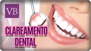 Mitos e Verdades do Clareamento Dental  Você Bonita 250117 [upl. by Aerbua]