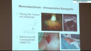 PD Dr med Anton Haid Feldkirch Intraoperative Sonografie [upl. by Eskill]