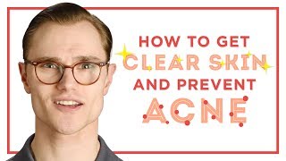 How To Get Clear Skin amp Prevent Acne  Skincare Tips for Men [upl. by Eenyaj504]