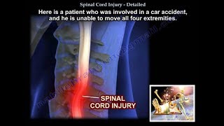 Spinal Cord Injury Detailed  Everything You Need To Know  Dr Nabil Ebraheim [upl. by Assirem]