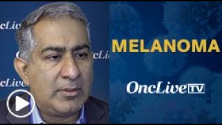 Dr Khushalani on FixedDose Treatment Regimens in Advanced Melanoma [upl. by Gnehc702]