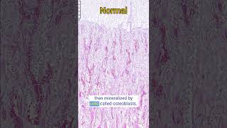 Osteogenesis Imperfecta in a Lamb [upl. by Doro]