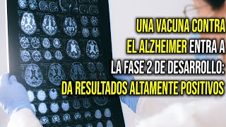 Una vacuna contra el Alzheimer entra a la fase 2 de desarrollo da resultados altamente positivos [upl. by Hilten885]