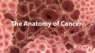 What Is Cancer What Causes Cancer amp How Is It Treated [upl. by Anelrad]