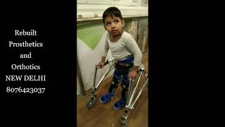 Cerebral palsy rehabilitation with Rebuilt Prosthetics and Orthotics [upl. by Atenaz382]