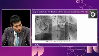 Learn the evidence  Lifetime management of aortic stenosis therapy with selfexpandable valve [upl. by Ajed]