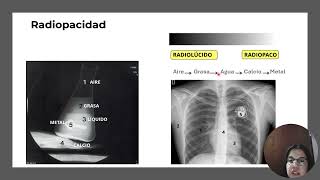 PPS  DENSIDADES RADIOLOGICAS BASICAS [upl. by Nylahs]