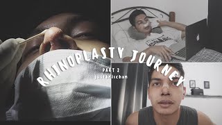 RECOVERY  1 MONTH POST OP REVEAL  MY RHINOPLASTY JOURNEY PART 2  PHILIPPINES  justkrischan [upl. by Enaoj]