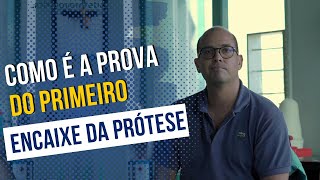 Primeira prótese de perna Prova do encaixe provisório [upl. by Arikihs]