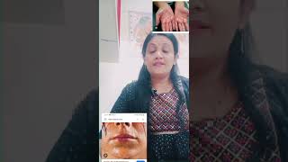 dr motivation Hyperhydrosis Homoeopathic medicine drpoonam Drpunam Sharmapathak [upl. by Iohk163]