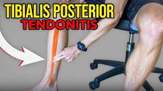 3 Exercises for Tibialis Posterior Tendonitis [upl. by Sidwohl]