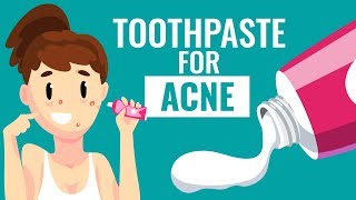 Is Using Toothpaste For Acne safe  Know the Truth [upl. by Highams]