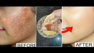 every skin type😍skincare beauty minivlog diy [upl. by Eugilegna]