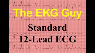 EKGECG Standard 12Lead ECG  Question 60 l The EKG Guy [upl. by Morley895]