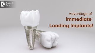 What are Basal Implants Or Immediate Loading Implants Dr Hussain Iqbal WardhawalaDoctors Circle [upl. by Einnor]