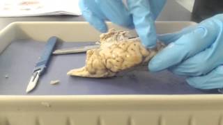 Brain Dissection [upl. by Alled]