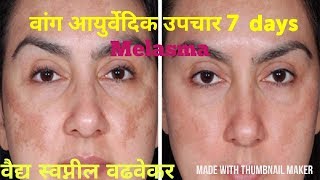 वांग वर घरगुती उपाय मराठी Melasma Pigmentation ayurvedic treatment vang upay marathi [upl. by Ecirahc874]