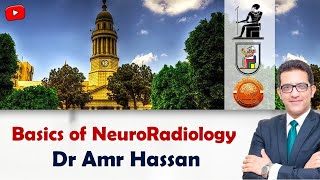 Basics of NeuroRadiologyأد عمرو حسن الحسني [upl. by Suilienroc]