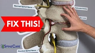 How to Fix a Bulging Disc in Your Lower Back  RELIEF IN SECONDS [upl. by Nylear]