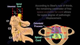 Cervical Spine Injury Steels Rule Of Thirds  Everything You Need To Know  Dr Nabil Ebraheim [upl. by Wycoff614]