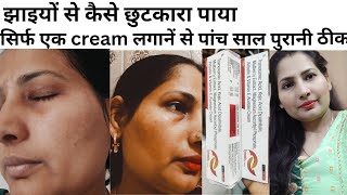 Cream For Pigmentation Pigmentation Removal Cream Skin Whitening Cream  झाइयां। [upl. by Lucania]