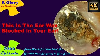 This Is The Ear Wax Blocked In Your Ear New Video Ear Wax Removal 1066 earwax earwaxremoval [upl. by Wilfrid]