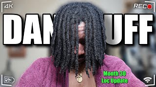 How I Deal with Dandruff  Month 30 Loc Update [upl. by Odnamla]