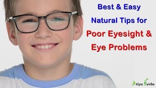 Best amp Easy Natural Tips for Poor Eyesight amp Eye Problems आँखों की समस्या का घरेलु उपचार [upl. by Aiynat]