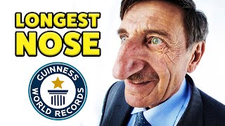 Life with the longest nose  Guinness World Records [upl. by Mclyman]