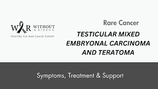 Testicular Mixed Embryonal Carcinoma and Teratoma [upl. by Ybbor]