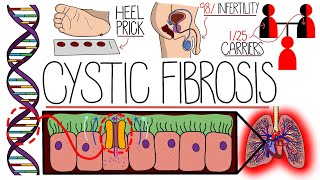 Understanding Cystic Fibrosis Includes Pathophysiology amp Diagnosis [upl. by Hnahc]