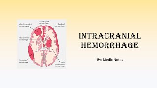 Intracranial hemorrhage  intracerebral vs extracerebral extradural subdural subarachnoid [upl. by Eednar618]