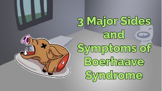 3 Major Sides and Symptoms of Boerhaave Syndrome Step 1 COMLEX NCLEX® PANCE AANP [upl. by Ofella455]