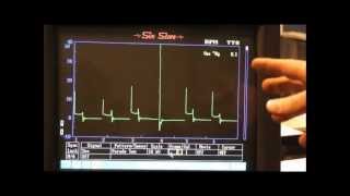 Secondary Ignition Waveforms common faults [upl. by Veronica]