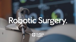 Robot Arm Assisted Surgery  Nuffield Health [upl. by Ewart]