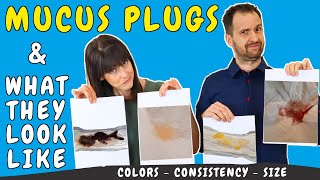 What does the mucus plug look like compared to other discharge  Mucus plug pictures and colors [upl. by Anastase]